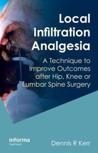 Local Infiltration Analgesia - A Technique to Improve Outcomes after Hip, Knee or Lumbar Spine Surgery