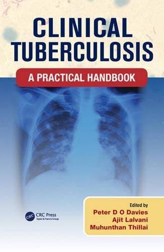 Clinical Tuberculosis - A Practical Handbook