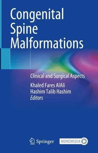 Congenital Spine Malformations - Clinical and Surgical Aspects